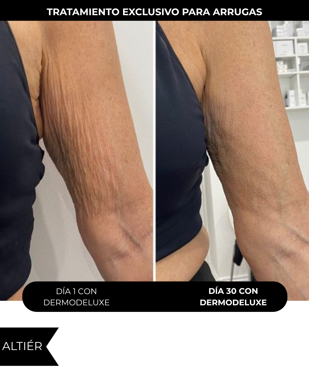 DERMODELUXE – Emulsión Corporal Anticelulitis, Antiflacidez y Efecto Drenante