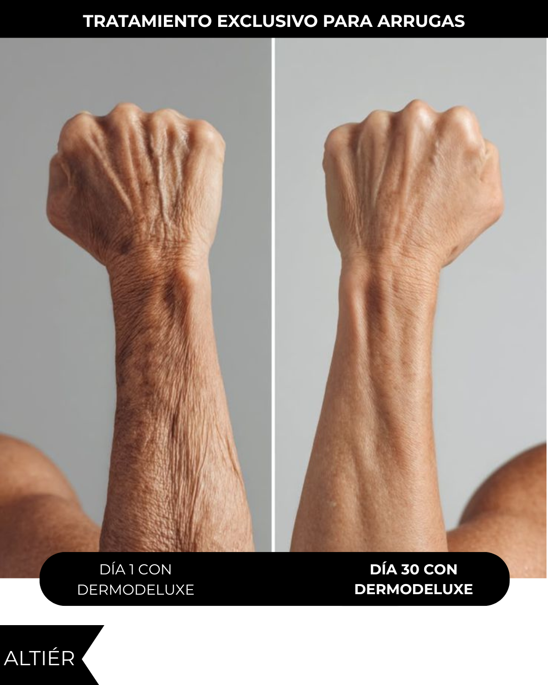 DERMODELUXE – Emulsión Corporal Anticelulitis, Antiflacidez y Efecto Drenante