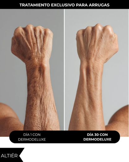 DERMODELUXE – Emulsión Corporal Anticelulitis, Antiflacidez y Efecto Drenante