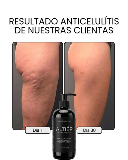 DERMODELUXE – Emulsión Corporal Anticelulitis, Antiflacidez y Efecto Drenante
