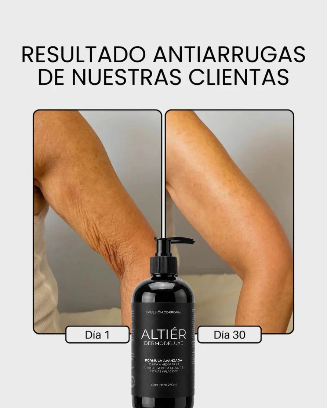 DERMODELUXE – Emulsión Corporal Anticelulitis, Antiflacidez y Efecto Drenante
